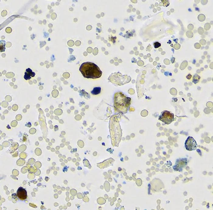 Microscopic view of airborne spores detected by SporeCount